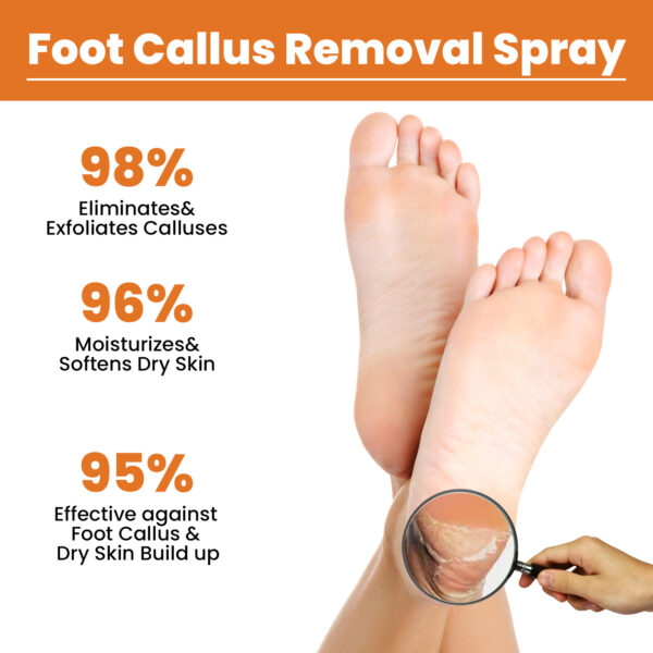 South Moon Foot Exfoliating Spray Gently Calluses Remove Dead Skin Cleansing Repair Rough Calluses - Image 3