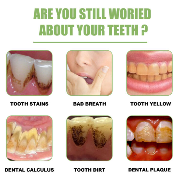 EELHOE Teeth Whitening Essence Cleans Tooth Stains Mouth Odor Beautiful Teeth Brightening Teeth Cleaning Essence - Image 3